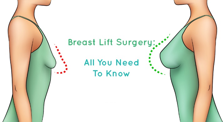 breast-lift-surgery